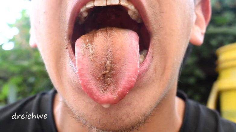 Dreichwe: Chocolate on the teeth