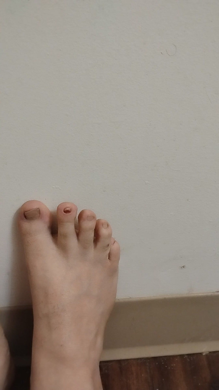 JG Risk: 11-26-2025 Cute Little Toes