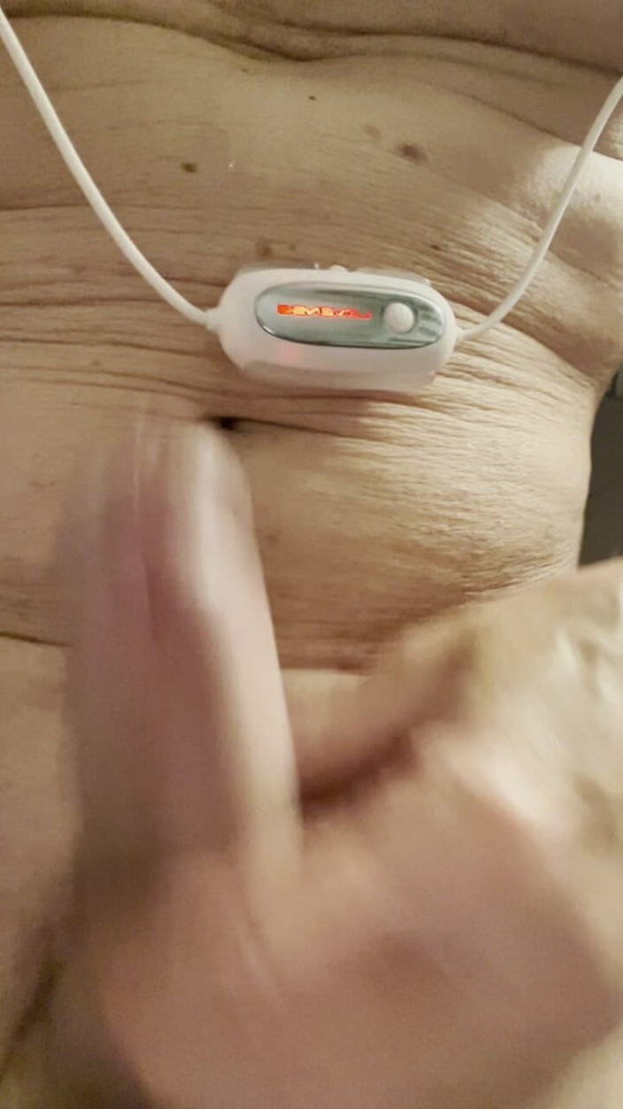 Mitchie: Runka Av Den Kåta Latten Och Runka Av De Fylliga...