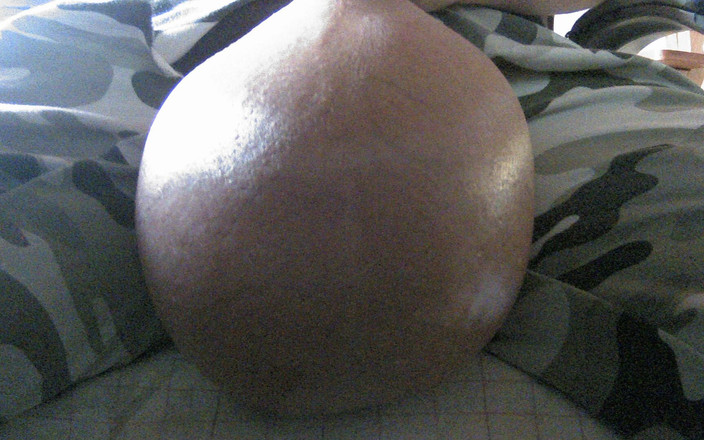 Gismo76: Glucose 5% 500 ml, nước muối 1500 ml