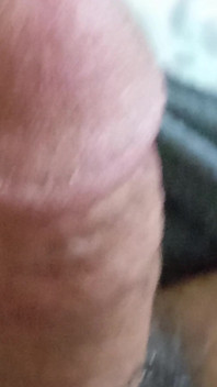 My Dick