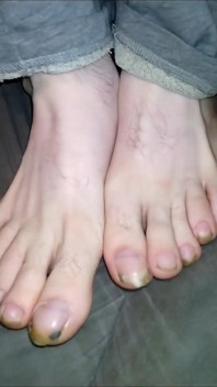 Foot Fancies