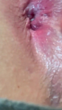 Solo Fingering of My Ass