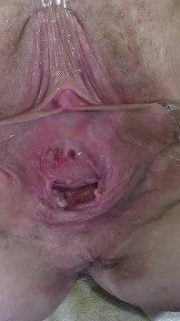 11 Pussy Tersebar Luas Close up Fuck Dengan Lampu 1000 Watt