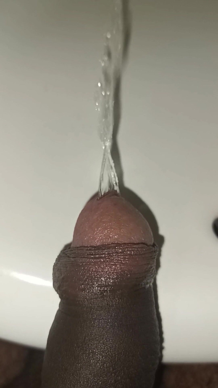 Tommhot: Çok fazla idrar derlemesi - sünnetsiz yarak işiyor