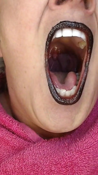 Big Wide Open Yawning