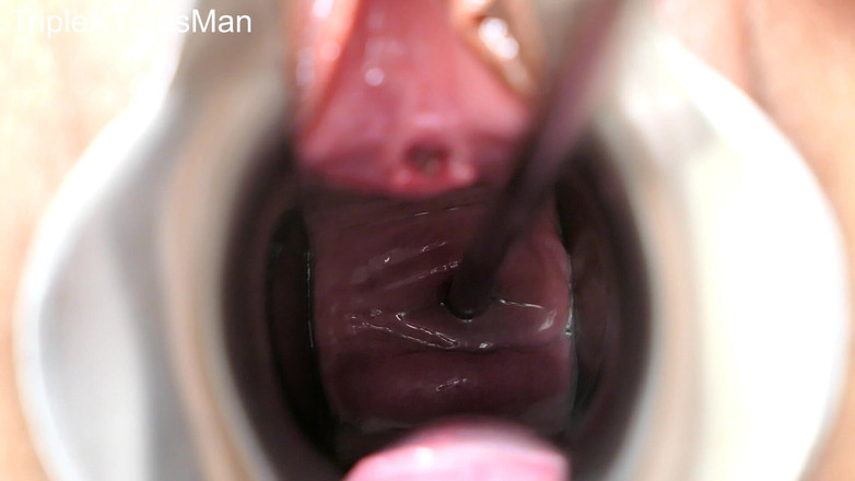 TripleXTransMan: Penetrując moją szyjkę macicy!