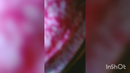 Beyblade: 여대생 침실 공연