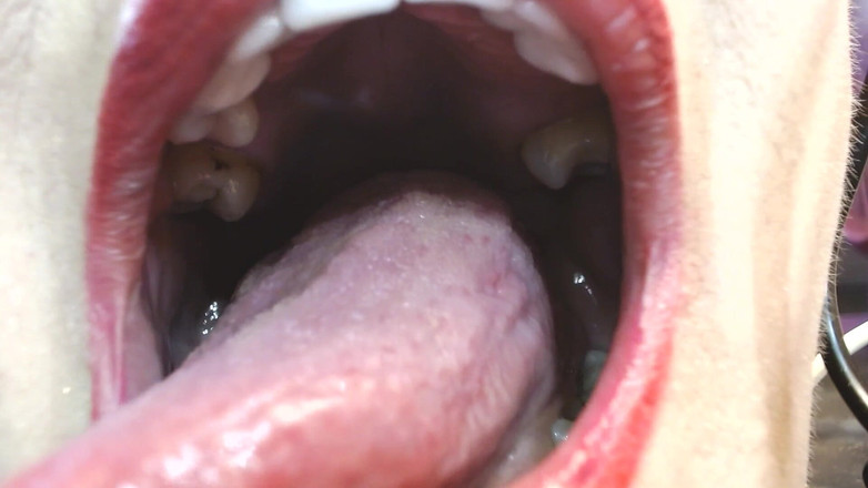 Abby Anna: 私の大きな口の舌の歯の口蓋垂の中