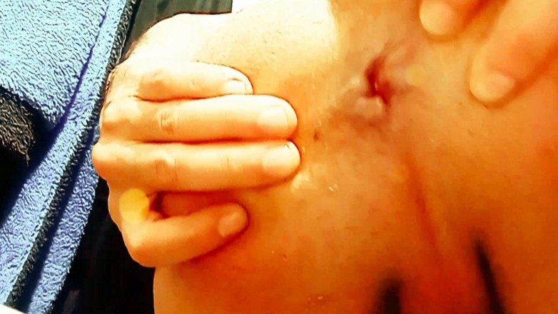 Willy Alexandru Petre: I Open My Round and Tight Hole