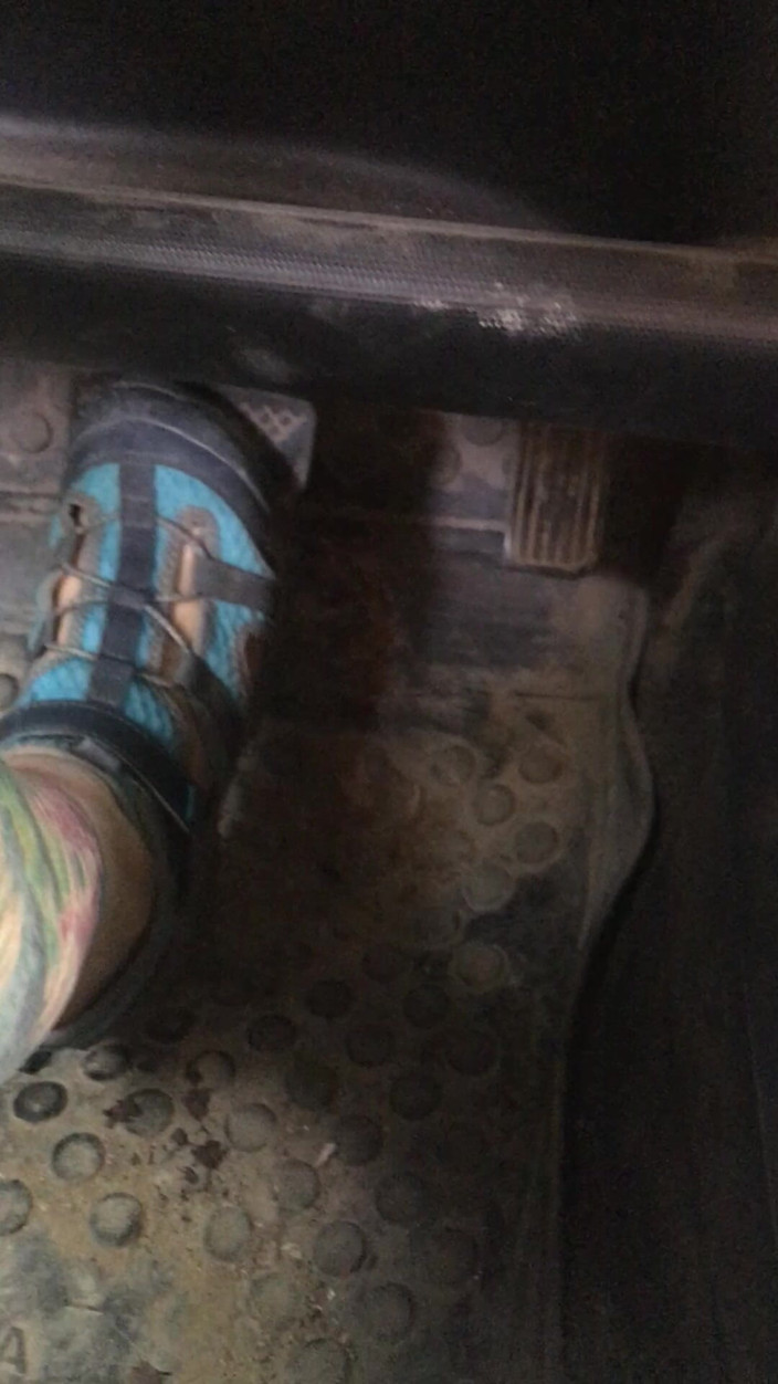 Risky Hairy Couple: I Press the Gas and Brake Pedals in Car