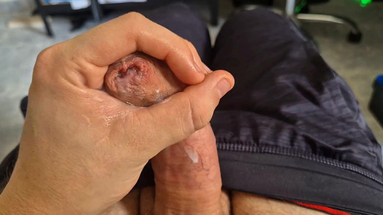 GloomyChase977: Phimosis 아빠. 사방에서 누설할 때까지 쓰다듬는 Ight foreskin
