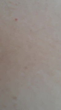 Close-up