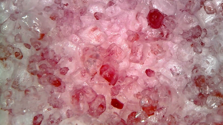 Nicoletta Embassi: Esame Orale Medico Endoscopico: Gommosa Da Masticare, Denti Estremi E...