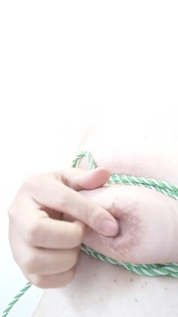 Breast
