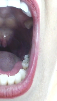 Inside My Big Mouth Tongue Teeth Uvula
