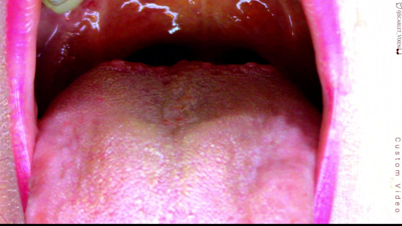 Scarlet Vixen: Scarlet sexy nói ahhhh - Uvula showoff