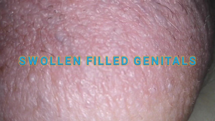 Monster_Meat_: Swollen obscene filled silicone filled meat