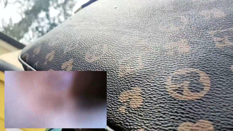 Nicoletta Embassi: Wallowing a Pill Cam While Walking Inside My Stomach POV
