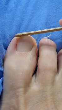 Cutting Toes Nails Feet Fetish