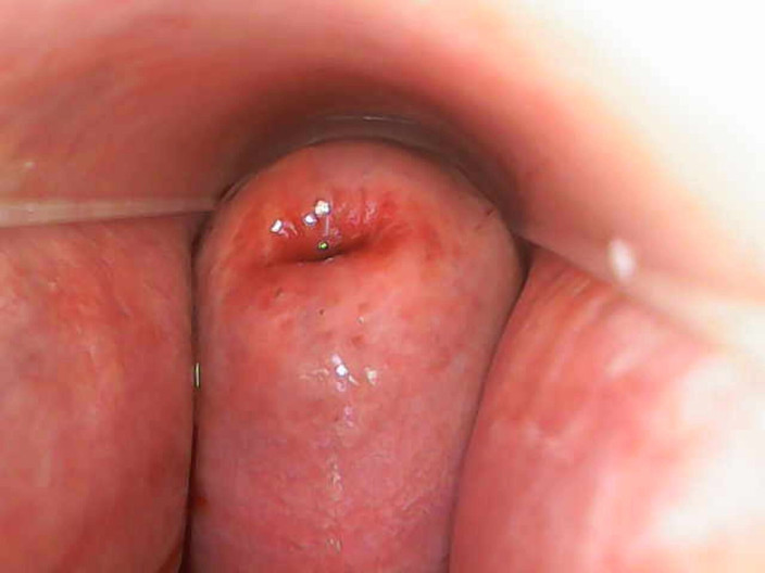 TripleXTransMan: La mia cervice da vicino