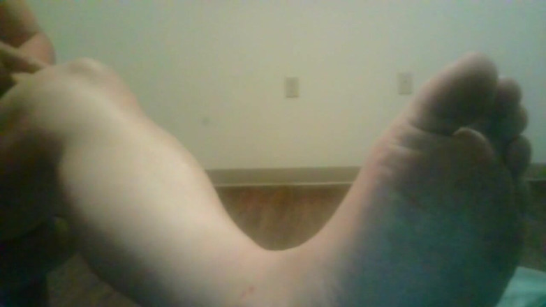 JG Risk: Left foot