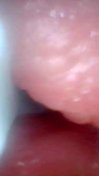 Kamera Endoskopi Menunjukkan Bagian Paling Sensitif dari Video Pendidikan Penis
