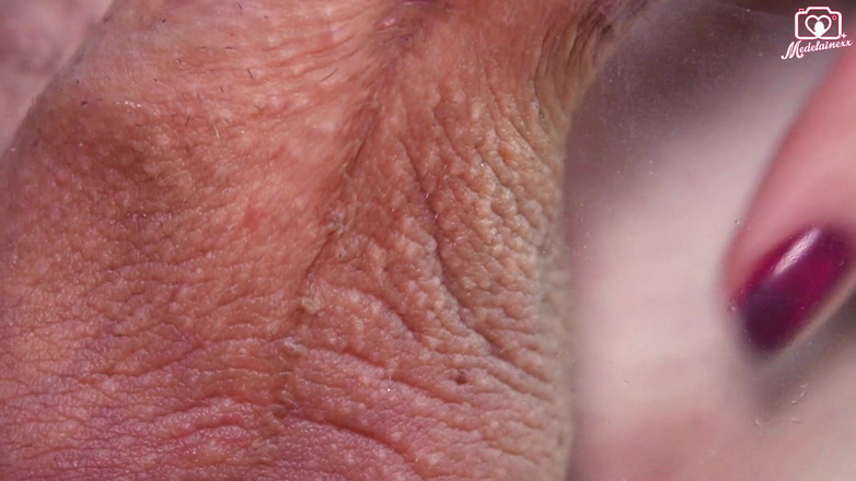 Medi Voi: Pencetus Kamera POV