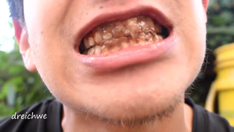 Dreichwe: Chocolate on the teeth