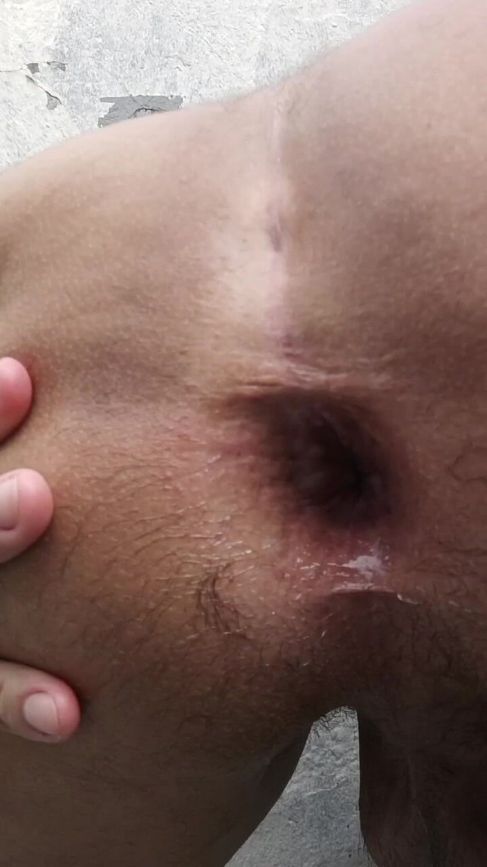 MiguellTrajano: 今、お尻が熱い