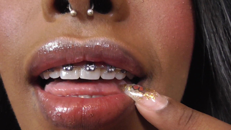 Solo Austria: Black girl teeth brace fetish!