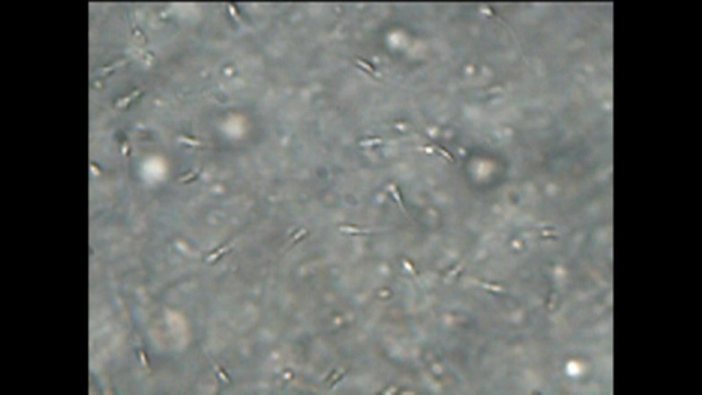 Mark Hannes: Sexdoll中出站着自慰，在显微下用精子自慰