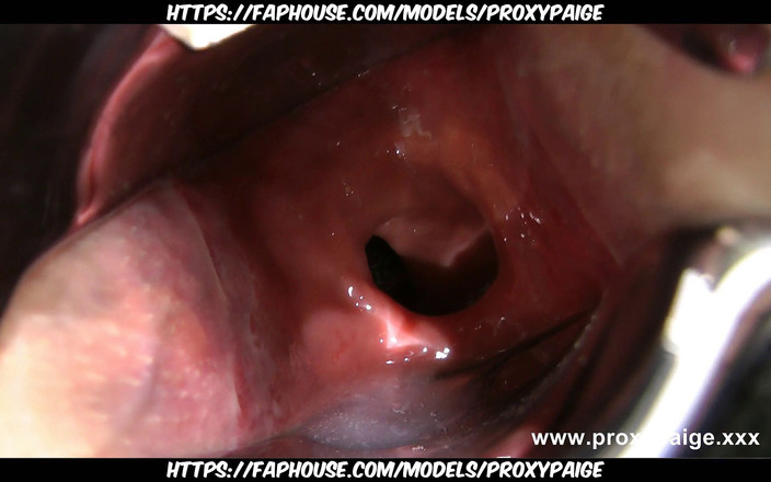 Proxypaige: Proxy-Paige, Glasplug und Xo Spekulanz