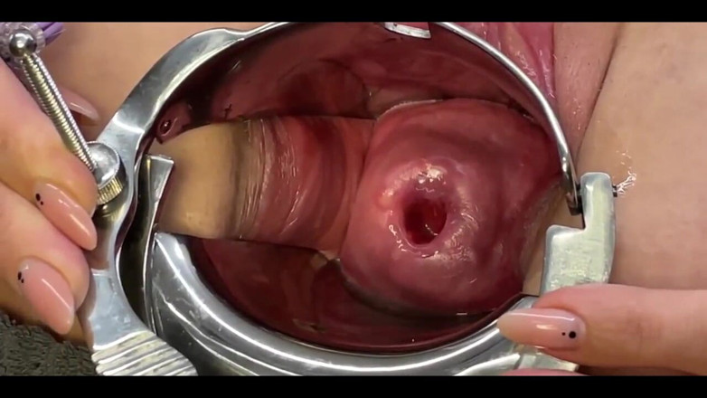 Crazywifeslut: Two Toothbrushes in Cervix