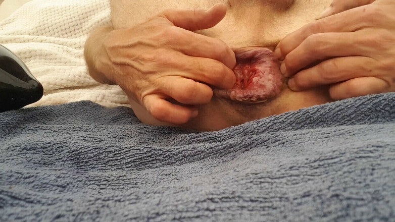 Fistboy: 풍선 플러그, 7cm