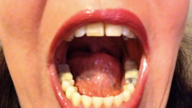 Lily Lipstixxx: Inspection de la bouche - fais attention, je mords !