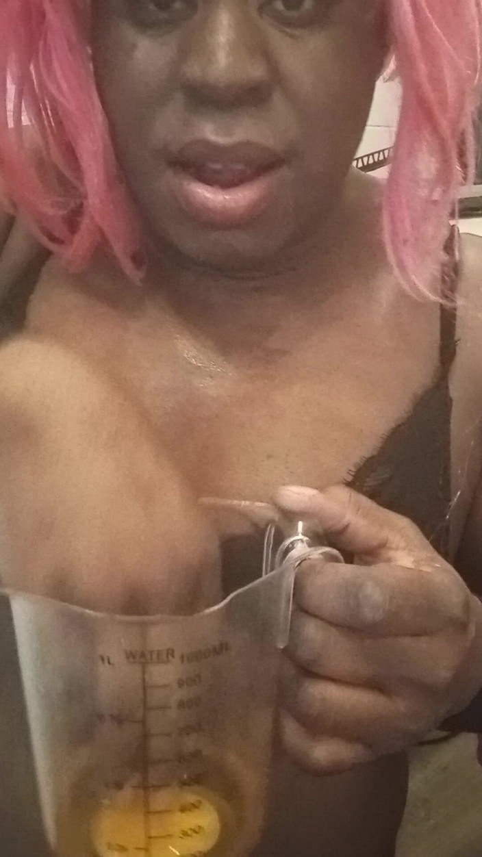 Anoniema Rose: オランダのオレンジ塩辛い小便を飲む