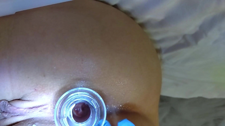 BABYGIRL 18YO: Video medical full 2