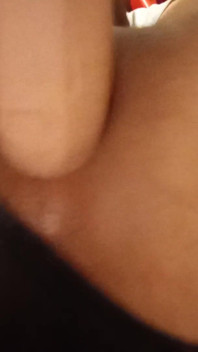My Little Ass Hole