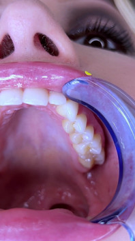 Teeth Fetish Extreme Close-up Dental Examination