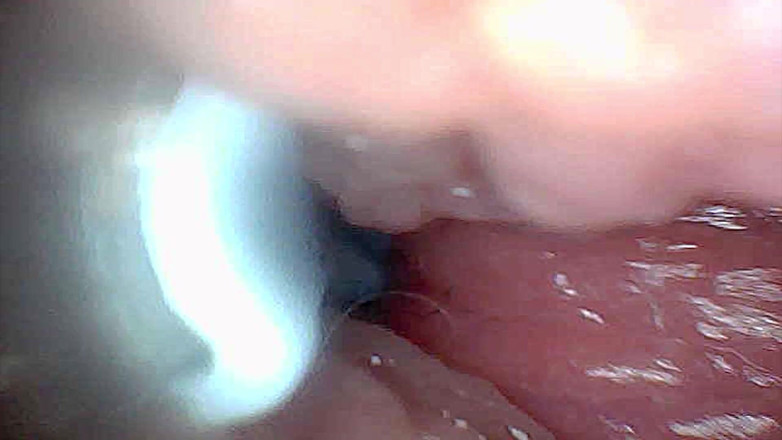 Ladybottox: Visual Guide to G-spot Stimulation and Orgasm Endoscop Perspective