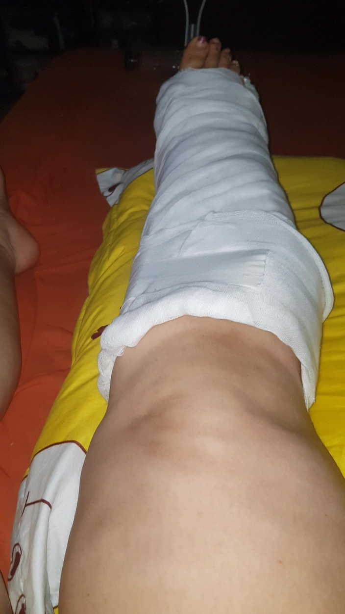 LoraBbw: Lắc lư các chân của tôi trong diễn viên