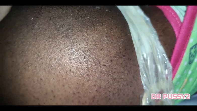 CASALTESUDEX: J’ai mal à la tête juste pour me faire baiser par...