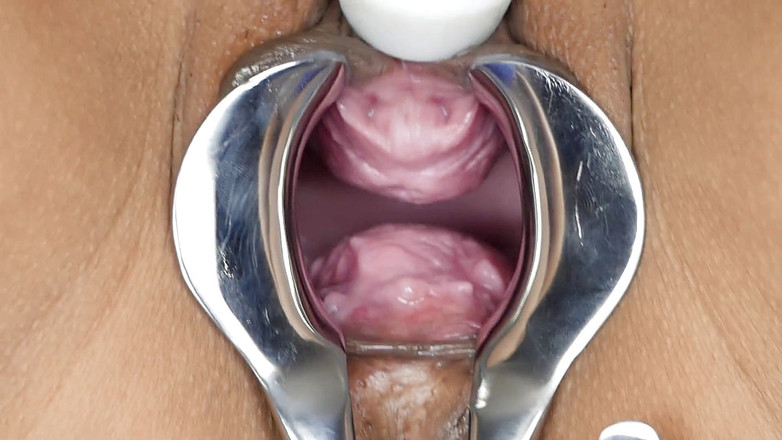 SexyThai1987: Speculum - içime bir bak