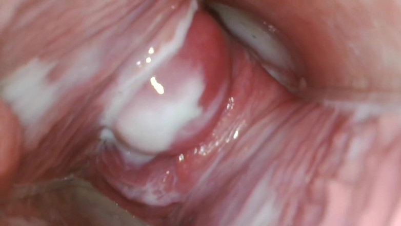 JANA studios: Endoscope in my pussy