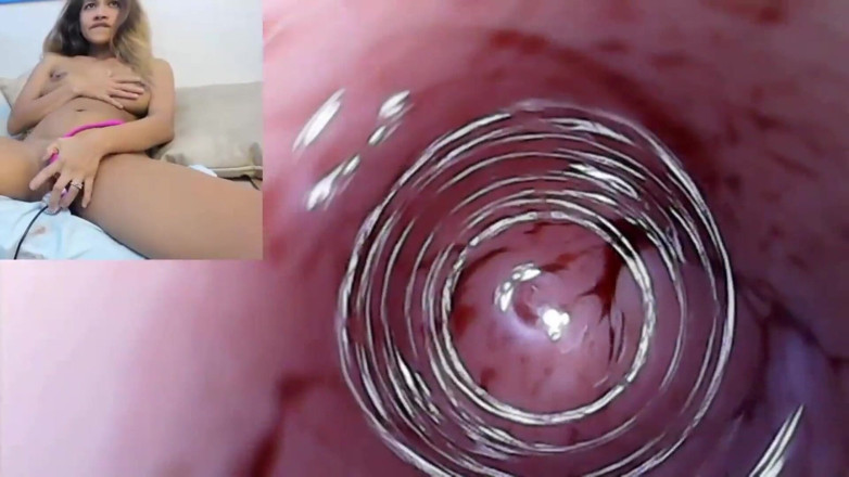 SexyGamingCouple: Endoscope Pussy Cam Footage of Creampie on Her Monthly with...