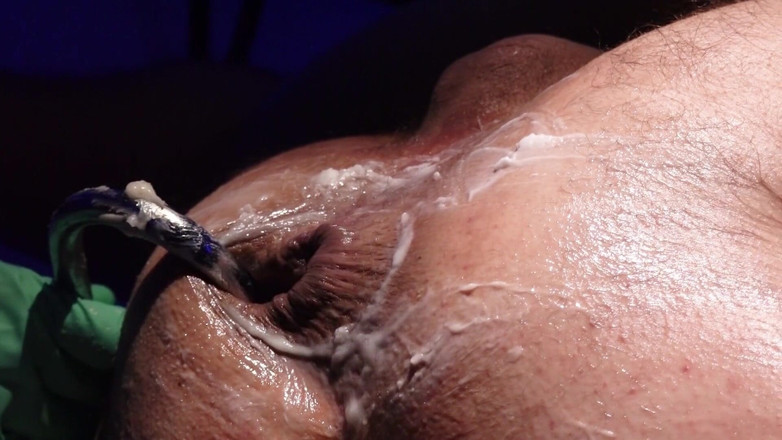 Marcus Pollack: Absolute Anal Treatment