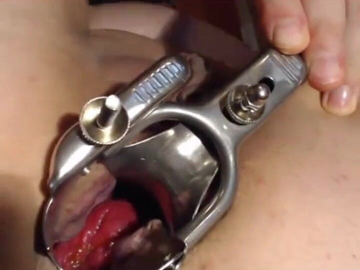 Putarankahotmilf: Speculum anal, prolapse, put water in my ass and pussy,...