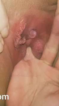 Finger Sounding and Punch Fisting