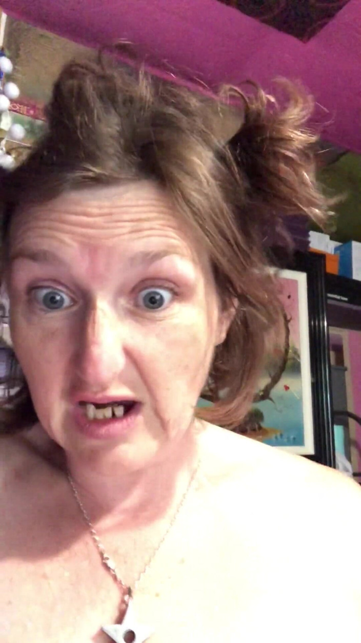 MistressWriggler: Rozprzestrzenianie My Hairy Pussy Lips Apart do cewnika sikanie do...